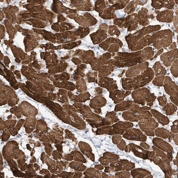 Anti-ZNF654 antibody produced in rabbit Prestige Antibodies&#174; Powered by Atlas Antibodies, affinity isolated antibody, buffered aqueous glycerol solution