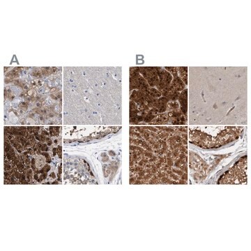 Anti-RBKS antibody produced in rabbit Prestige Antibodies&#174; Powered by Atlas Antibodies, affinity isolated antibody, buffered aqueous glycerol solution