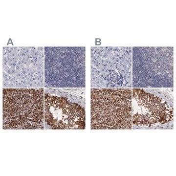 Anti-SLMAP antibody produced in rabbit Ab2, Prestige Antibodies&#174; Powered by Atlas Antibodies, affinity isolated antibody, buffered aqueous glycerol solution