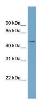 Anti-ACVR2B antibody produced in rabbit affinity isolated antibody