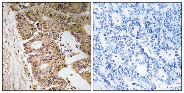 Anti-ZC3H8 antibody produced in rabbit affinity isolated antibody