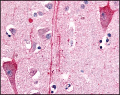 Anti-HTR7 (AB2) antibody produced in rabbit affinity isolated antibody, buffered aqueous solution