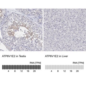 Anti-ATP6V1E2 antibody produced in rabbit Prestige Antibodies&#174; Powered by Atlas Antibodies, affinity isolated antibody, buffered aqueous glycerol solution