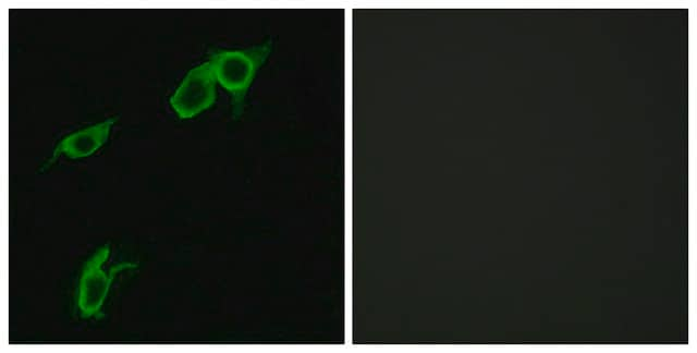 Anti-GPR75 antibody produced in rabbit affinity isolated antibody