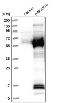 Anti-PRKAR1B antibody produced in rabbit Prestige Antibodies&#174; Powered by Atlas Antibodies, affinity isolated antibody, buffered aqueous glycerol solution