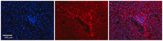 Anti-FTL affinity isolated antibody