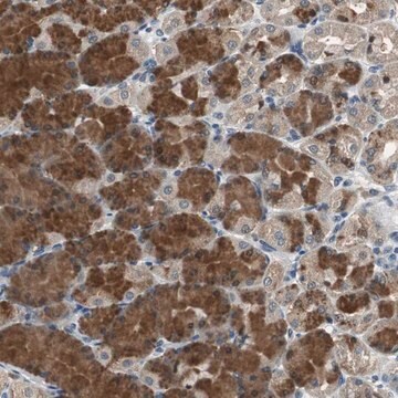 Anti-PI4KB antibody produced in rabbit Ab2, Prestige Antibodies&#174; Powered by Atlas Antibodies, affinity isolated antibody, buffered aqueous glycerol solution