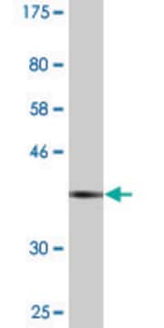 Monoclonal Anti-ARPC5 antibody produced in mouse clone 2D10, purified immunoglobulin, buffered aqueous solution