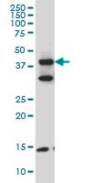 Monoclonal Anti-FBLIM1 antibody produced in mouse clone 5E11, purified immunoglobulin, buffered aqueous solution