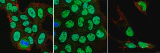 Anti-MBD5 from rabbit, purified by affinity chromatography