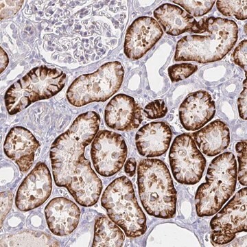 Anti-KCTD19 antibody produced in rabbit Prestige Antibodies&#174; Powered by Atlas Antibodies, affinity isolated antibody, buffered aqueous glycerol solution