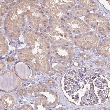 Anti-RABGAP1L antibody produced in rabbit Prestige Antibodies&#174; Powered by Atlas Antibodies, affinity isolated antibody, buffered aqueous glycerol solution