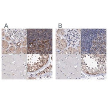 Anti-PFAS antibody produced in rabbit Prestige Antibodies&#174; Powered by Atlas Antibodies, affinity isolated antibody, buffered aqueous glycerol solution, Ab1