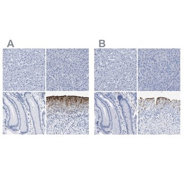 Anti-UPK3A antibody produced in rabbit Prestige Antibodies&#174; Powered by Atlas Antibodies, affinity isolated antibody, buffered aqueous glycerol solution, Ab3