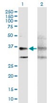 Anti-GPRC5A antibody produced in mouse purified immunoglobulin, buffered aqueous solution