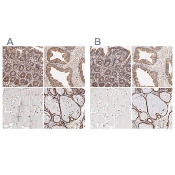 Anti-PDIA3 antibody produced in rabbit Ab1, Prestige Antibodies&#174; Powered by Atlas Antibodies, affinity isolated antibody, buffered aqueous glycerol solution