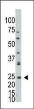 Anti-ADPRH (C-term) antibody produced in rabbit IgG fraction of antiserum, buffered aqueous solution