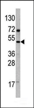 ANTI-VEGFD (VEGF4)(C-TERMINAL) antibody produced in rabbit IgG fraction of antiserum, buffered aqueous solution