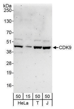 Rabbit anti-CDK9 Antibody, Affinity Purified Powered by Bethyl Laboratories, Inc.