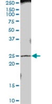 Anti-PRTFDC1 antibody produced in mouse purified immunoglobulin, buffered aqueous solution