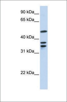 Anti-ETV6 (ab1) antibody produced in rabbit affinity isolated antibody