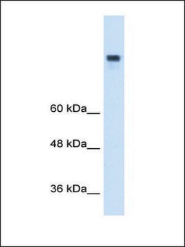 Anti-MTTP affinity isolated antibody