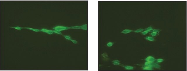 Anti-SNAP-29 antibody produced in rabbit IgG fraction of antiserum, buffered aqueous solution