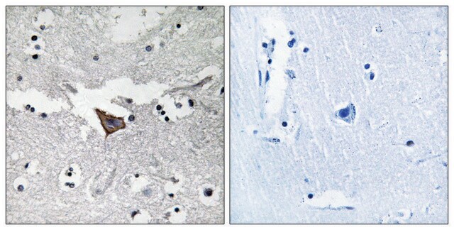 Anti-FAK antibody produced in rabbit affinity isolated antibody