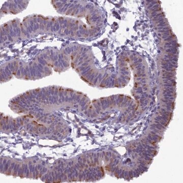 Anti-BBS7 antibody produced in rabbit Prestige Antibodies&#174; Powered by Atlas Antibodies, affinity isolated antibody, buffered aqueous glycerol solution