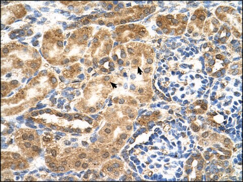 Anti-GCNT3 antibody produced in rabbit IgG fraction of antiserum