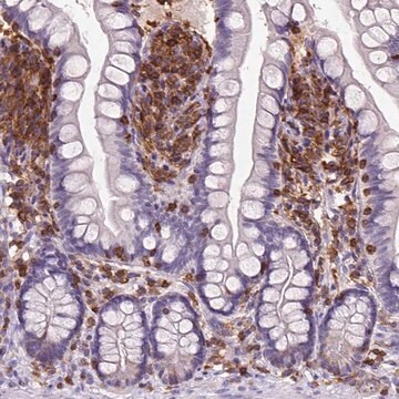 Anti-INPP5D antibody produced in rabbit Prestige Antibodies&#174; Powered by Atlas Antibodies, affinity isolated antibody, buffered aqueous glycerol solution