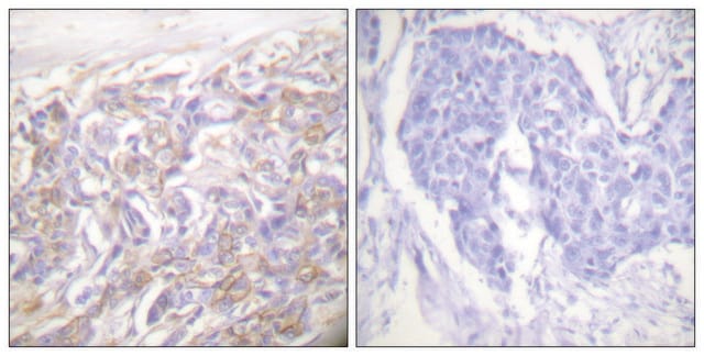 Anti-TNF Receptor I antibody produced in rabbit affinity isolated antibody