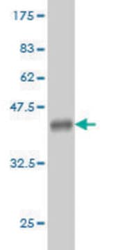 Monoclonal Anti-GUK1, (C-terminal) antibody produced in mouse clone 1H3, ascites fluid