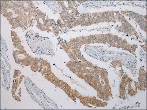 Anti-ITLN2 affinity isolated antibody