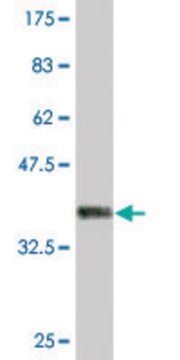 Monoclonal Anti-IARS, (C-terminal) antibody produced in mouse clone 3D3, purified immunoglobulin, buffered aqueous solution