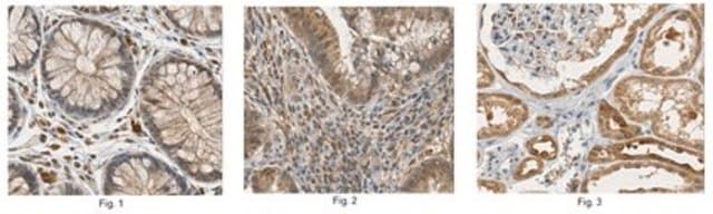 Anti-Corticotropin-Releasing-Factor-Rezeptor&nbsp;2-Antikörper 1.0&#160;mg/mL, from rabbit