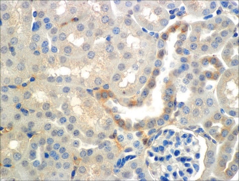 Monoclonal Anti-ENaC beta-Atto 488 antibody produced in mouse clone 7B8