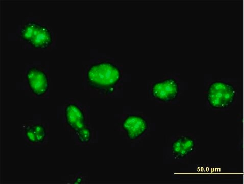 Anti-NOLC1 antibody produced in mouse purified immunoglobulin, buffered aqueous solution