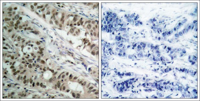 Anti-FOXO1 (Ab-256) antibody produced in rabbit affinity isolated antibody