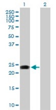 Anti-RAB31 antibody produced in rabbit purified immunoglobulin, buffered aqueous solution