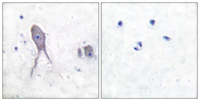 Anti-NOTCH2 (Cleaved-Asp1733) antibody produced in rabbit affinity isolated antibody