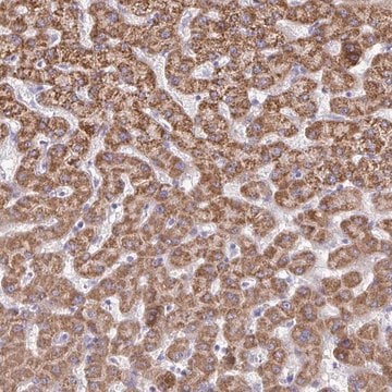 Anti-ACSM2A antibody produced in rabbit Prestige Antibodies&#174; Powered by Atlas Antibodies, affinity isolated antibody, buffered aqueous glycerol solution