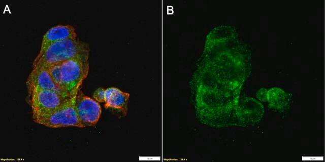 Anti-PNPLA2/ATGL Antibody, clone 2G22 ZooMAb&#174; Rabbit Monoclonal recombinant, expressed in HEK 293 cells