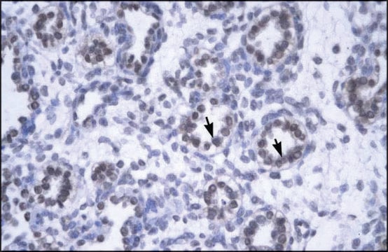 Anti-YEATS4 antibody produced in rabbit affinity isolated antibody