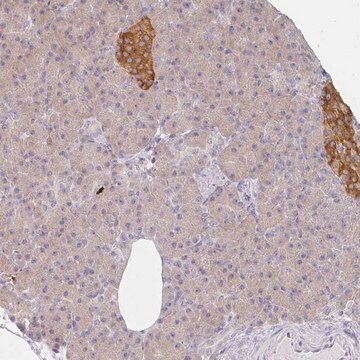 Anti-AMPD2 antibody produced in rabbit Prestige Antibodies&#174; Powered by Atlas Antibodies, affinity isolated antibody, buffered aqueous glycerol solution