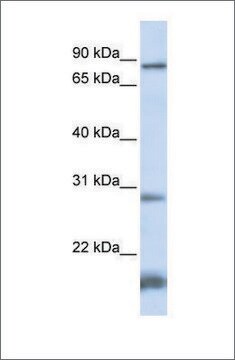 Anti-SMYD4 antibody produced in rabbit affinity isolated antibody