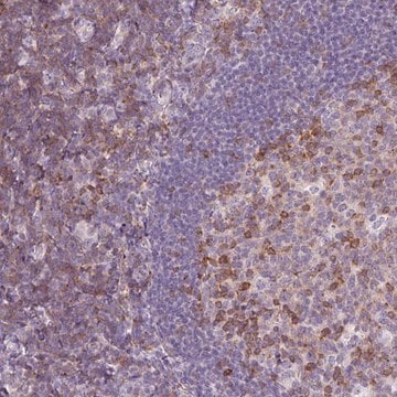 Anti-TIGD2 antibody produced in rabbit Prestige Antibodies&#174; Powered by Atlas Antibodies, affinity isolated antibody, buffered aqueous glycerol solution