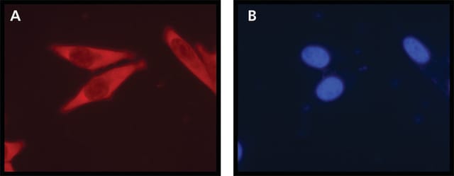 Anti-Ribosomal Protein L26 (N-terminal) ~1&#160;mg/mL, affinity isolated antibody, buffered aqueous solution