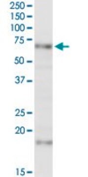 Anti-MCCC2 antibody produced in rabbit purified immunoglobulin, buffered aqueous solution