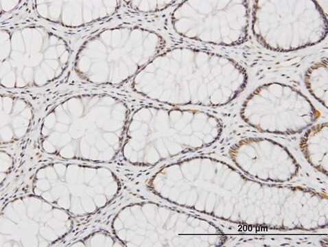 Monoclonal Anti-KLF11, (C-terminal) antibody produced in mouse clone 10D8, purified immunoglobulin, buffered aqueous solution